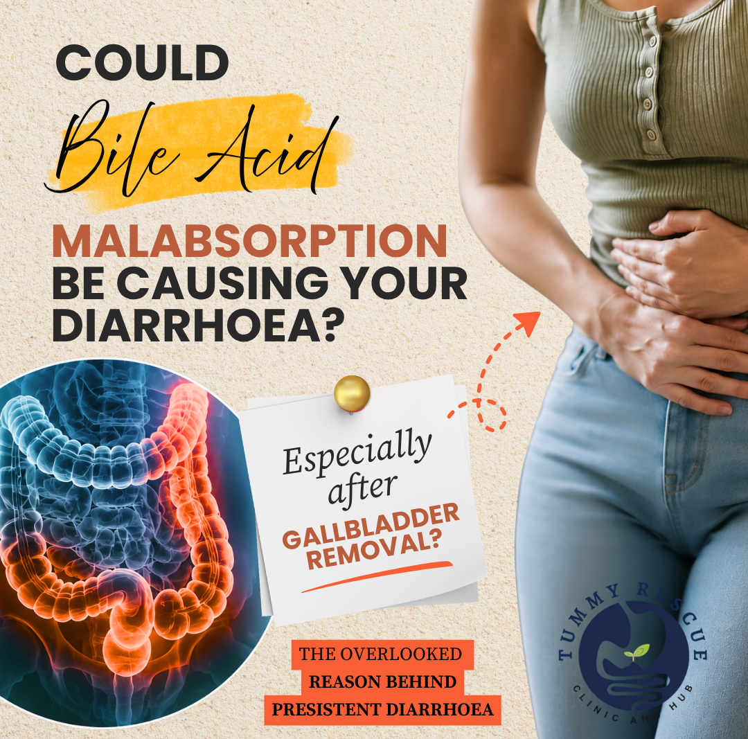 Could Bile Acid Malabsorption (BAM) Be Causing Your Diarrhoea? Especially After Gallbladder Removal