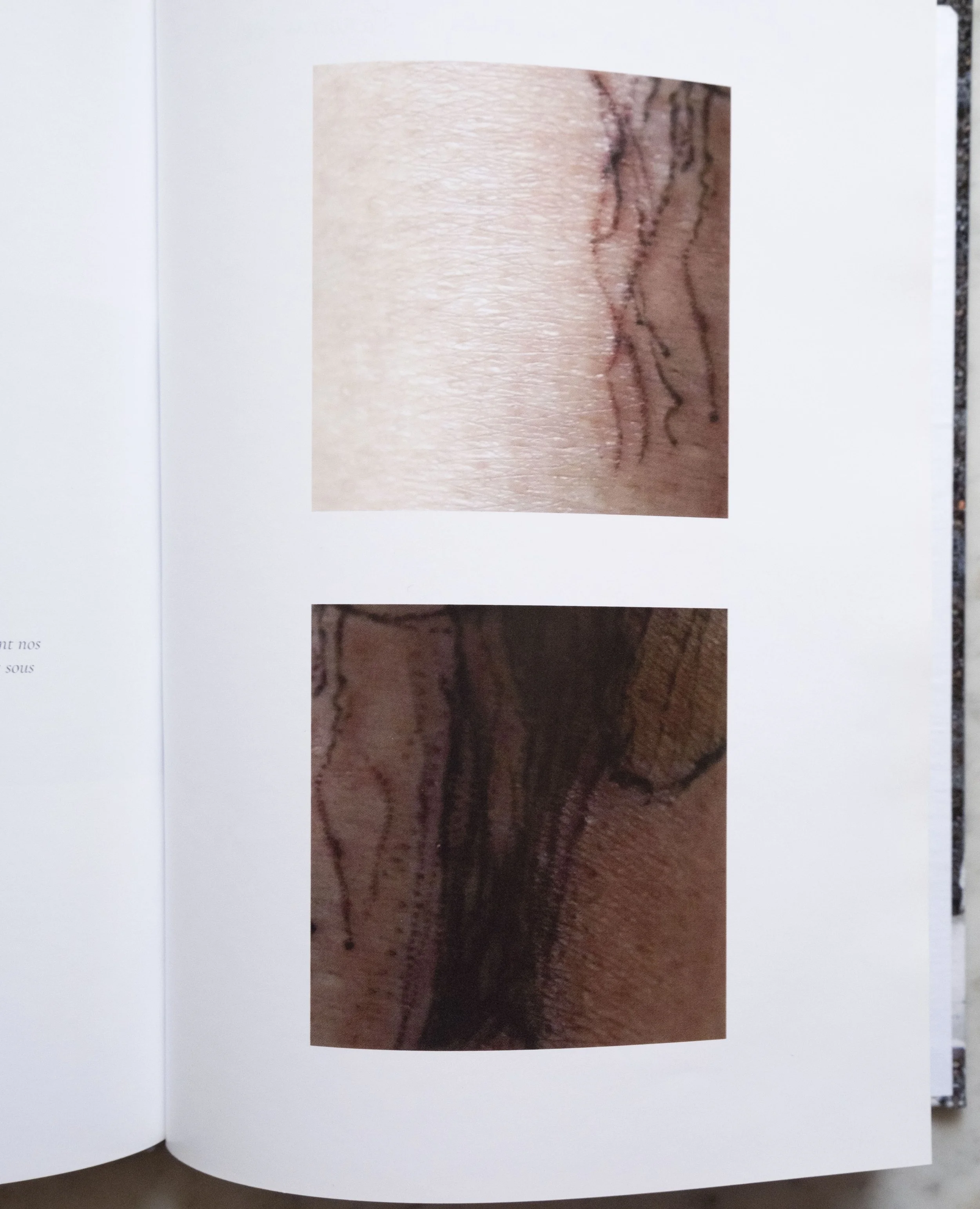 Analysis of coagulation in relation to ink and the tearing of the skin. In parallel, when we print a photograph, the image that settles manifests in much the same way…