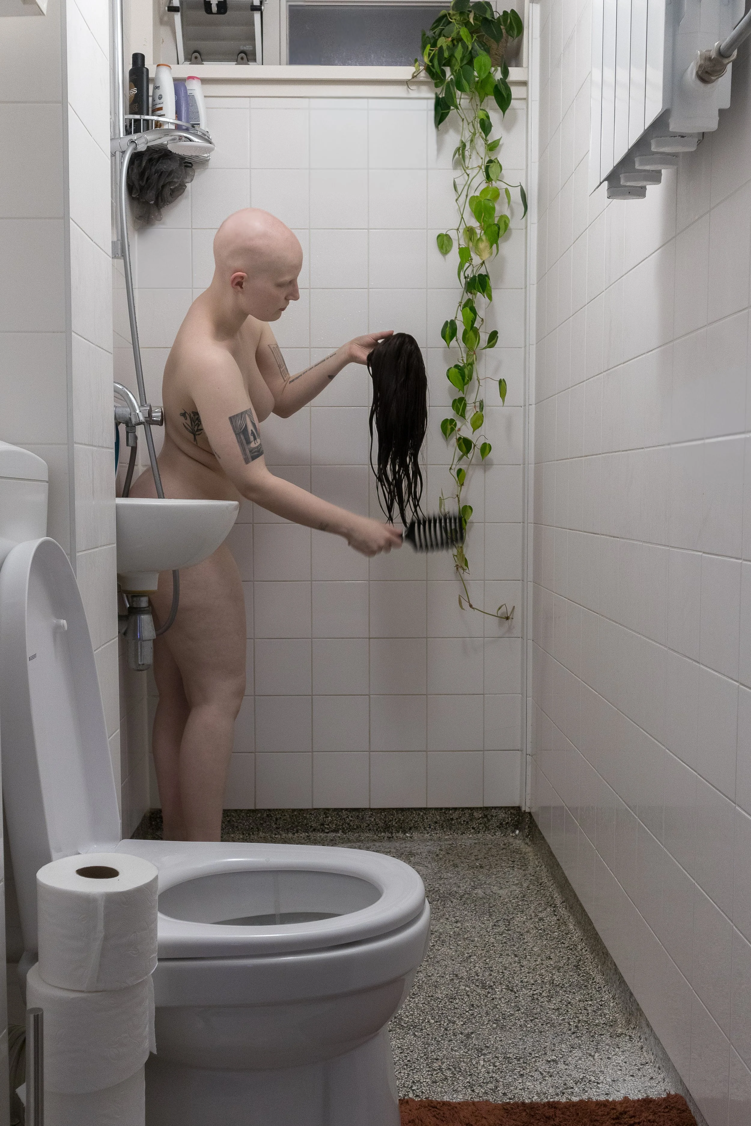 Alopecia updated-1113.jpg