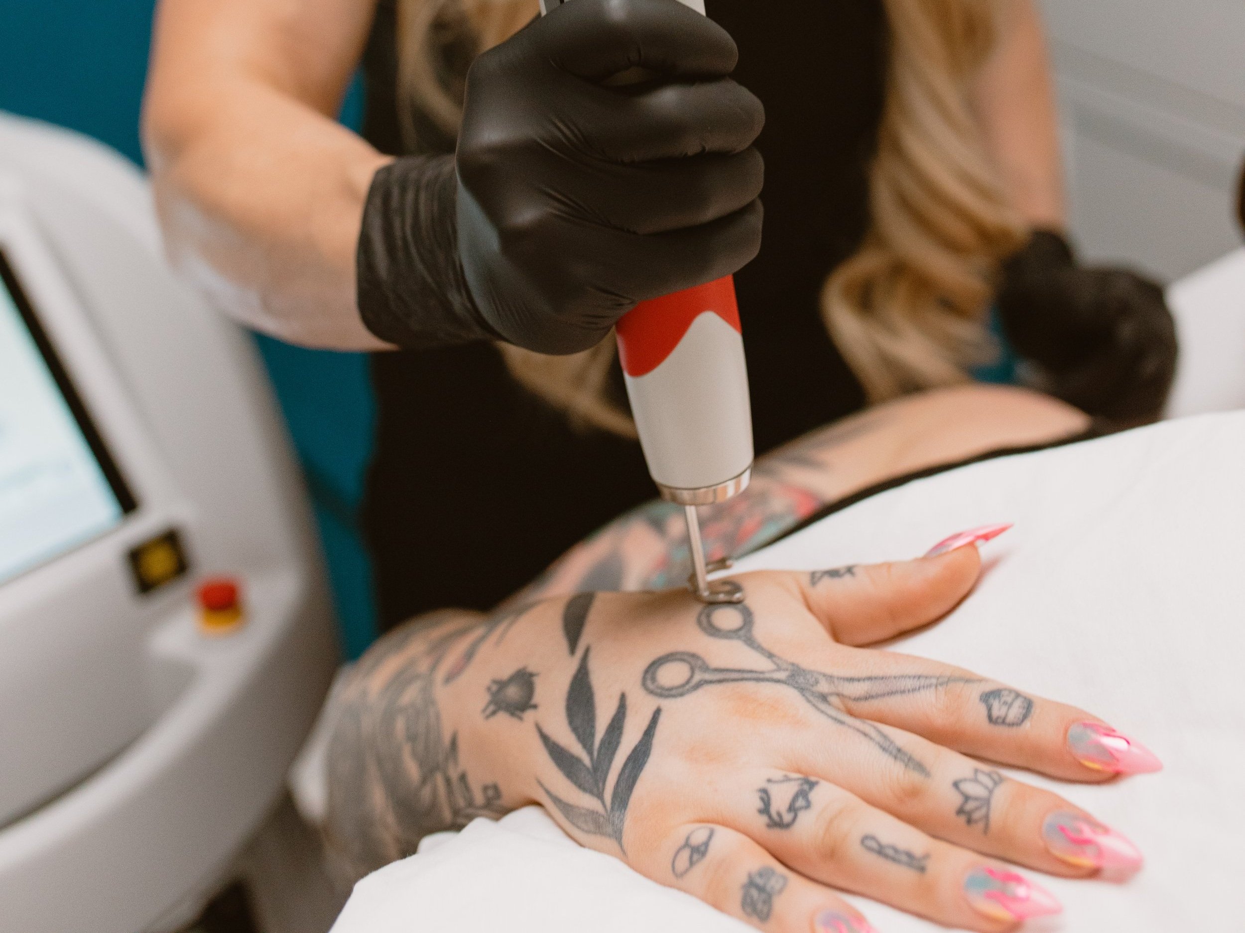 Jobseeker Mark Cropp's 'Devast8' tattoo getting lasered off - NZ Herald