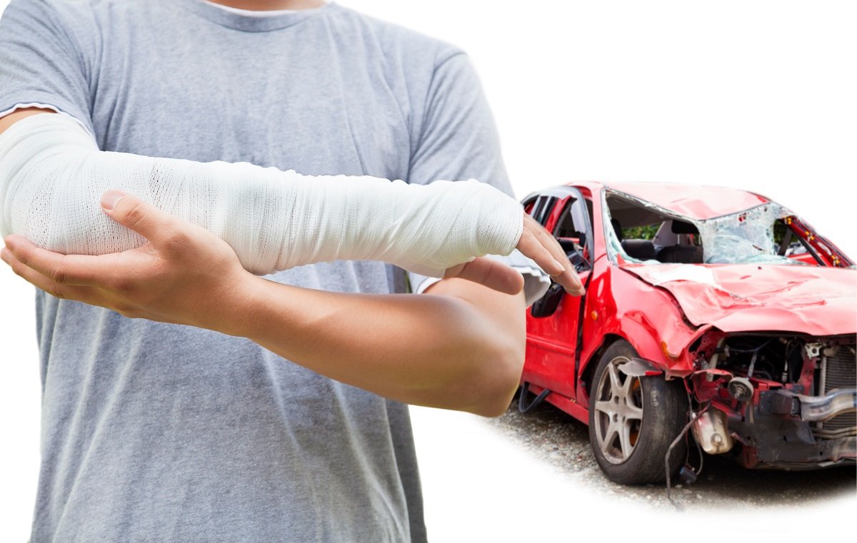 How Much Compensation Is Available for Arm and Leg Accident Injuries?