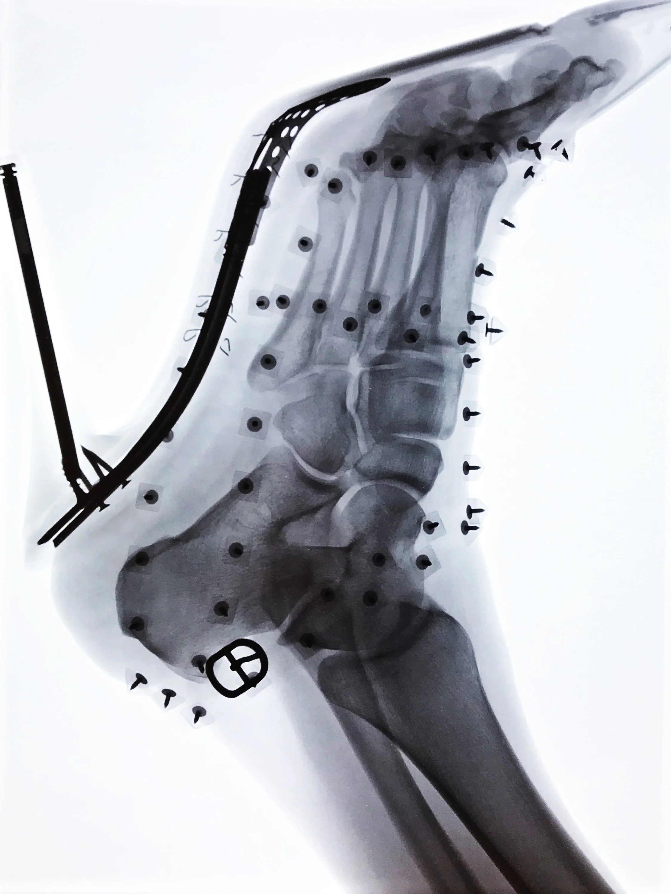 XRAY3 copy.JPG