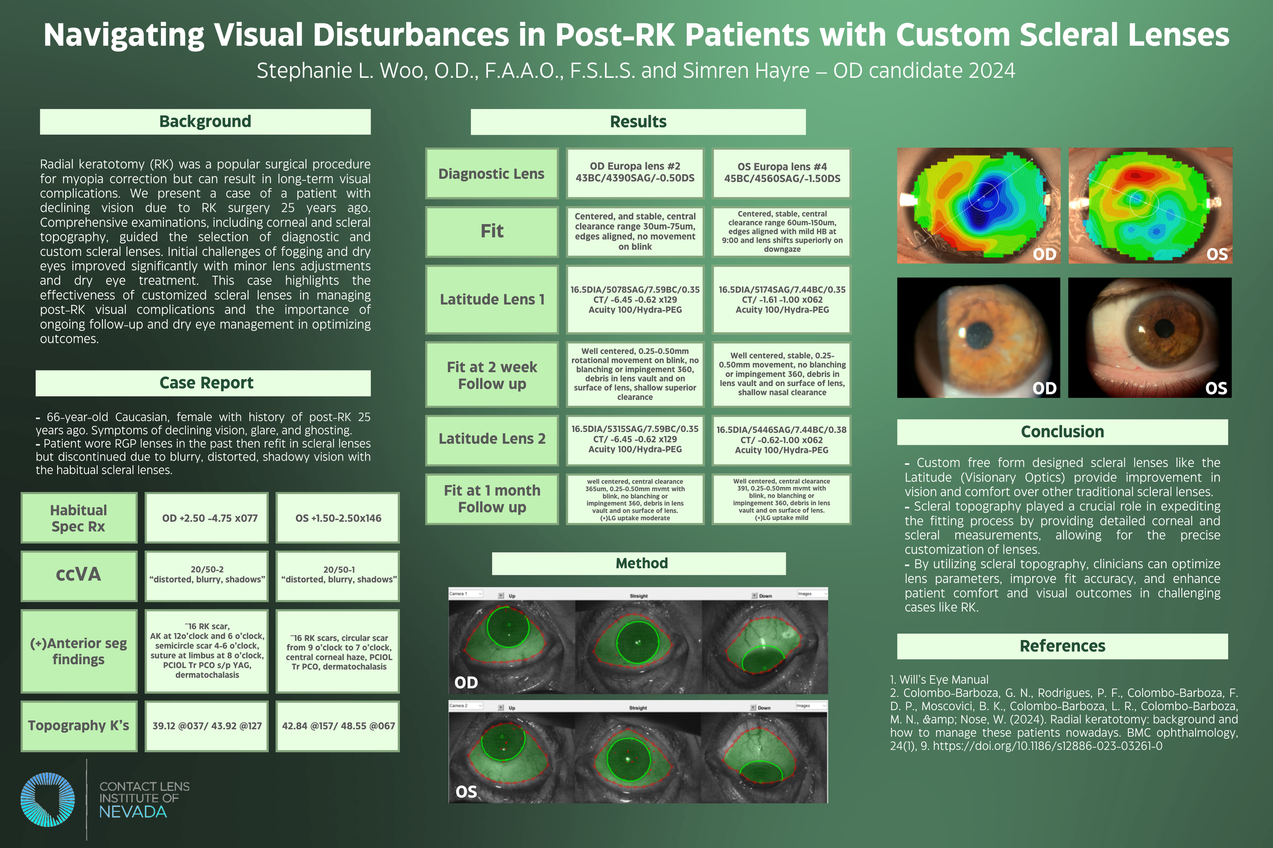 Navigating Visual Disturbances in Post-RK Patients with Custom Scleral Lenses - Dr. Woo & Hayre.png