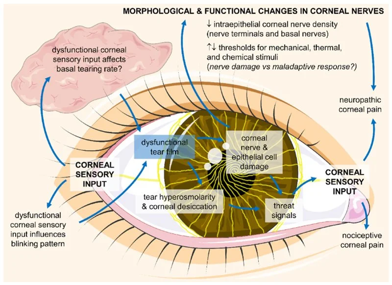Beyond Dry Eye: Advancing Your Approach to Complex Corneal and Ocular Surface Disease