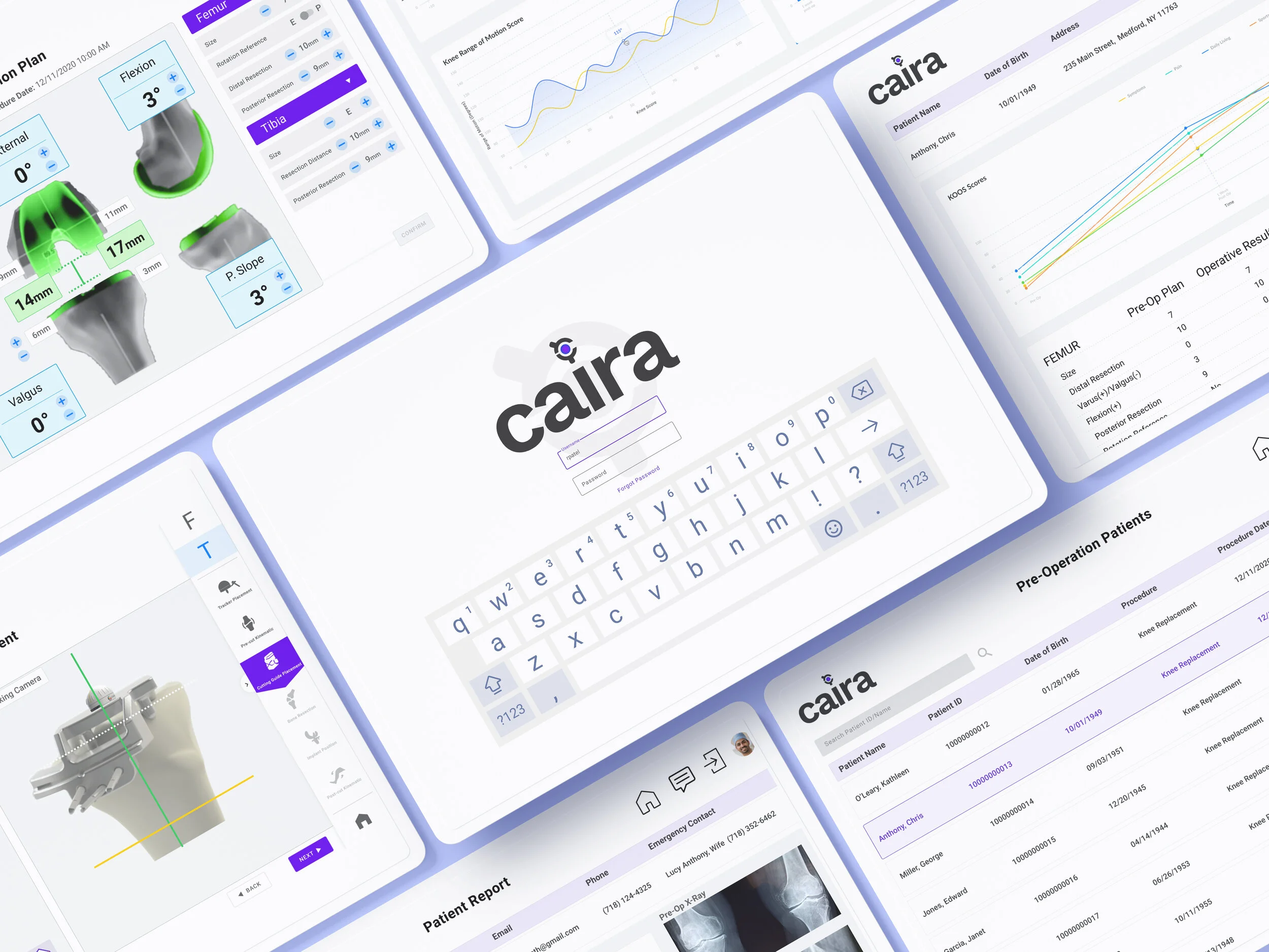 CAIRA Surgical