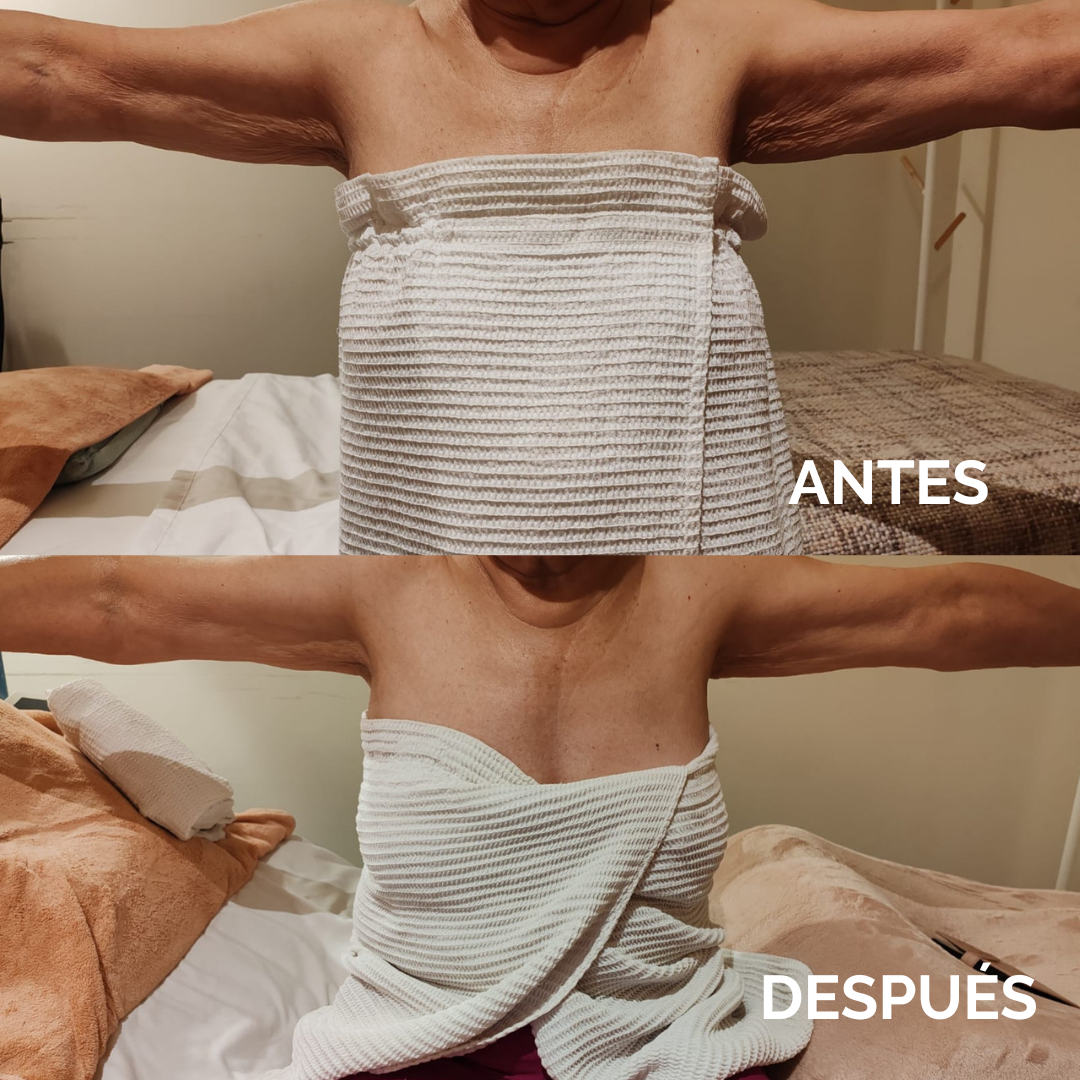 Depilación IPL en cualquier zona (4).png