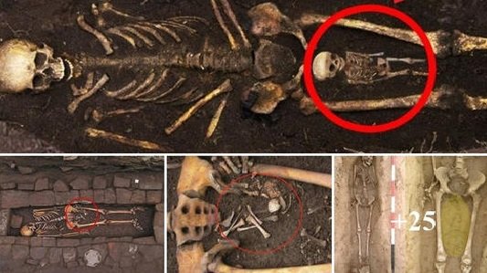 Skeleton of Four Breasted Woman Discovered – EMToast