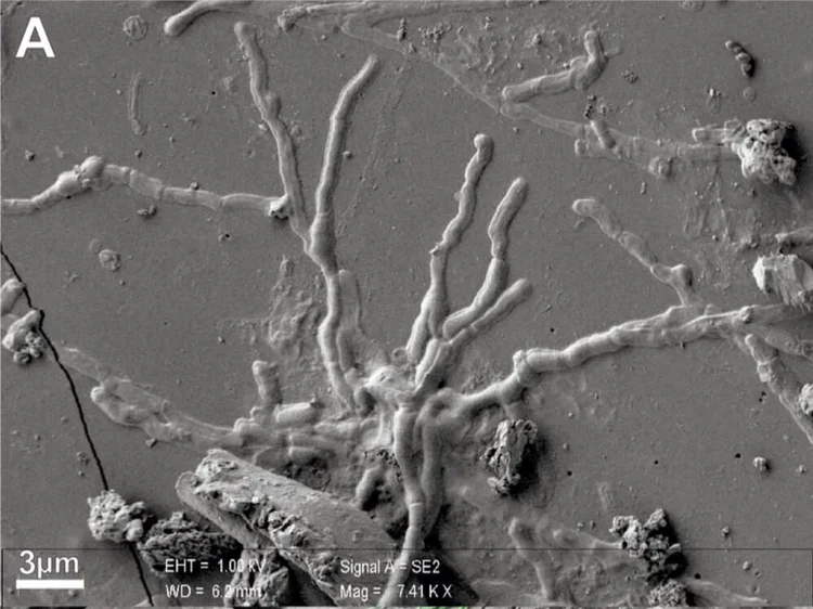 Scientists Discover Intact Brain Cells After Studying Victims of Mount ...