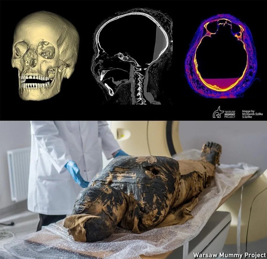 Unraveling the Mystery The Truth Behind the "Mysterious Lady" Mummy Unraveling the Mystery The Truth Behind the "Mysterious Lady" Mummy