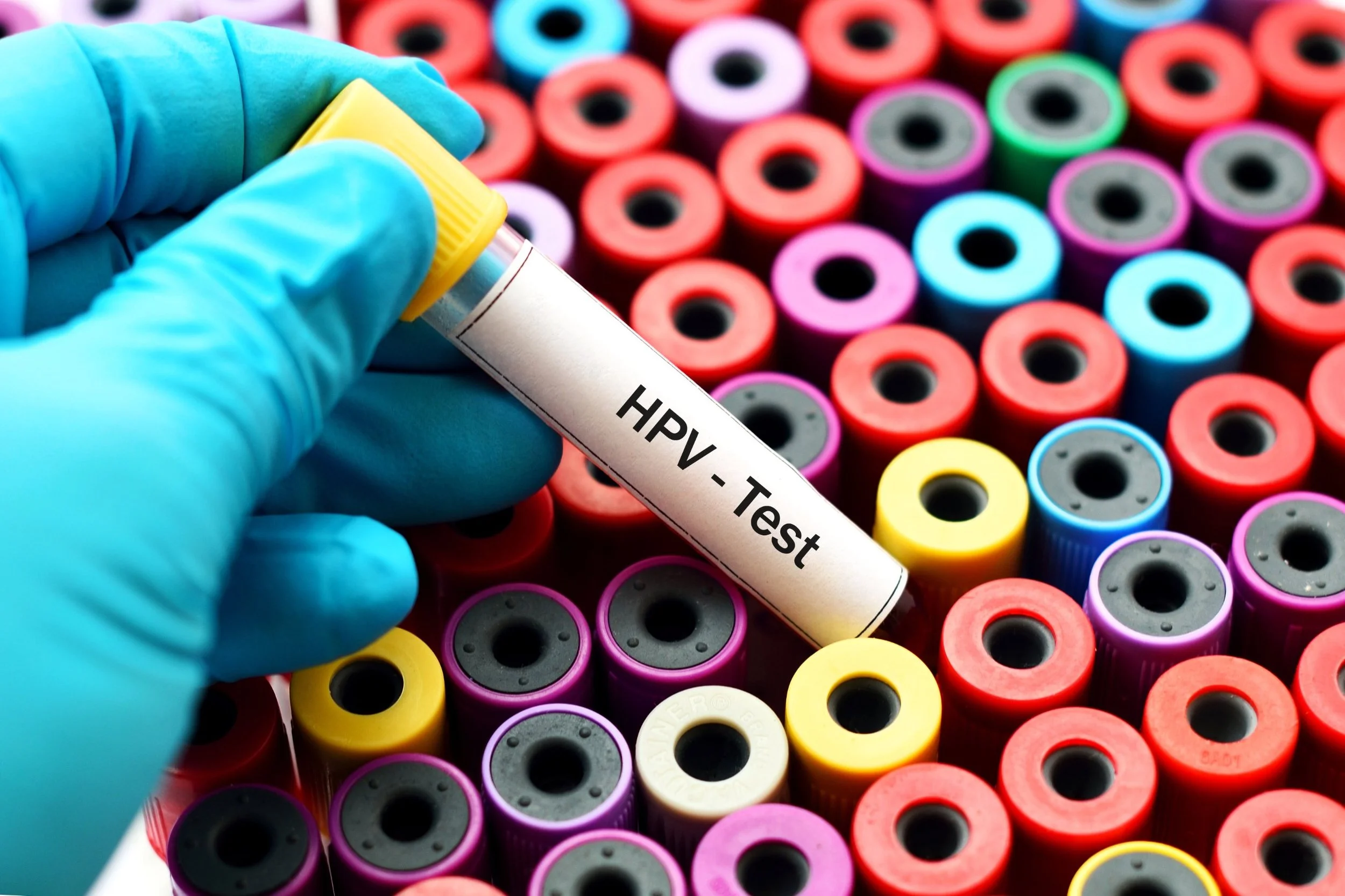 HPV - Causes, Tests &amp; Prevention