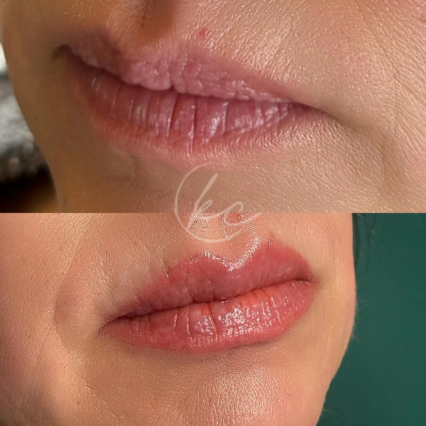 First Session Lip Blush 💋

For her first Lip Blushing appointment, we opted for a soft, natural shade that complements any look, day or night. ✨
This subtle color gives her a beautiful, effortless tint while allowing the flexibility to go bolder in 