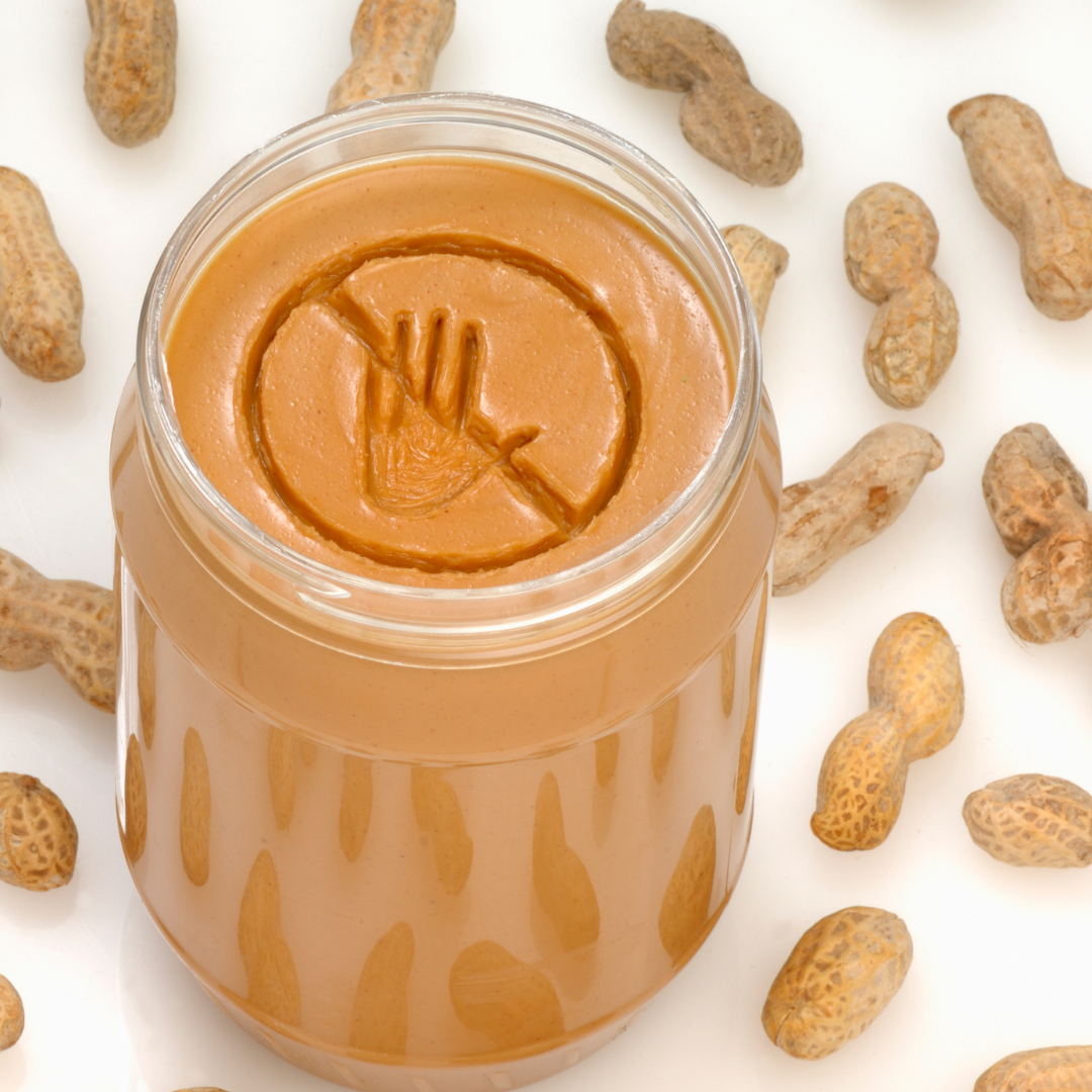 Eczema triggers and grading — THE PEDIATRICIAN MOM