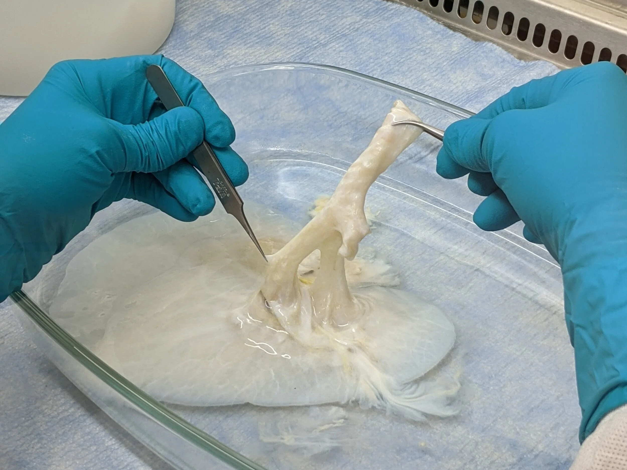 In the image above, the upper airway region is being held by two forceps. Descending from the right pair of forceps, several cartilage rings are visible along the surface of the airway. These rings appear white while the remaining sections of the air