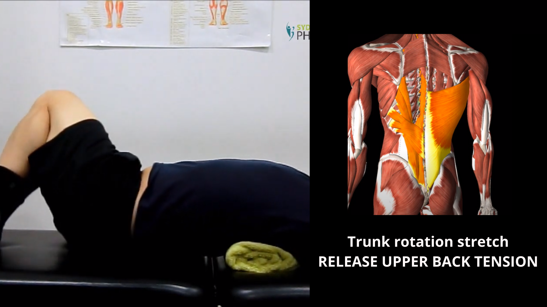 Sydney Health Physiotherapy Resources - Back β Sydney Health Physiotherapy