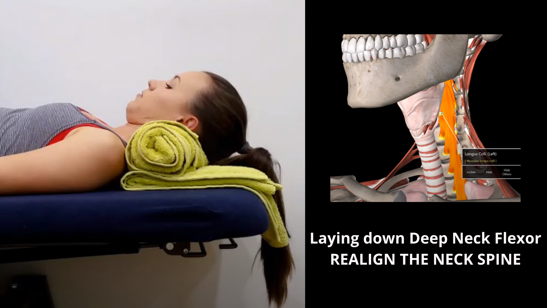 Laying down Deep Neck Flexor — Sydney Health Physiotherapy