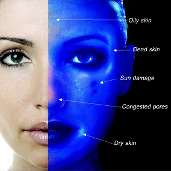 A split image showing a woman's face with normal skin on the left side and a photographic overlay with blue tint on the right side. The right side highlights skin issues such as oily skin, dead skin, sun damage, congested pores, and dry skin.