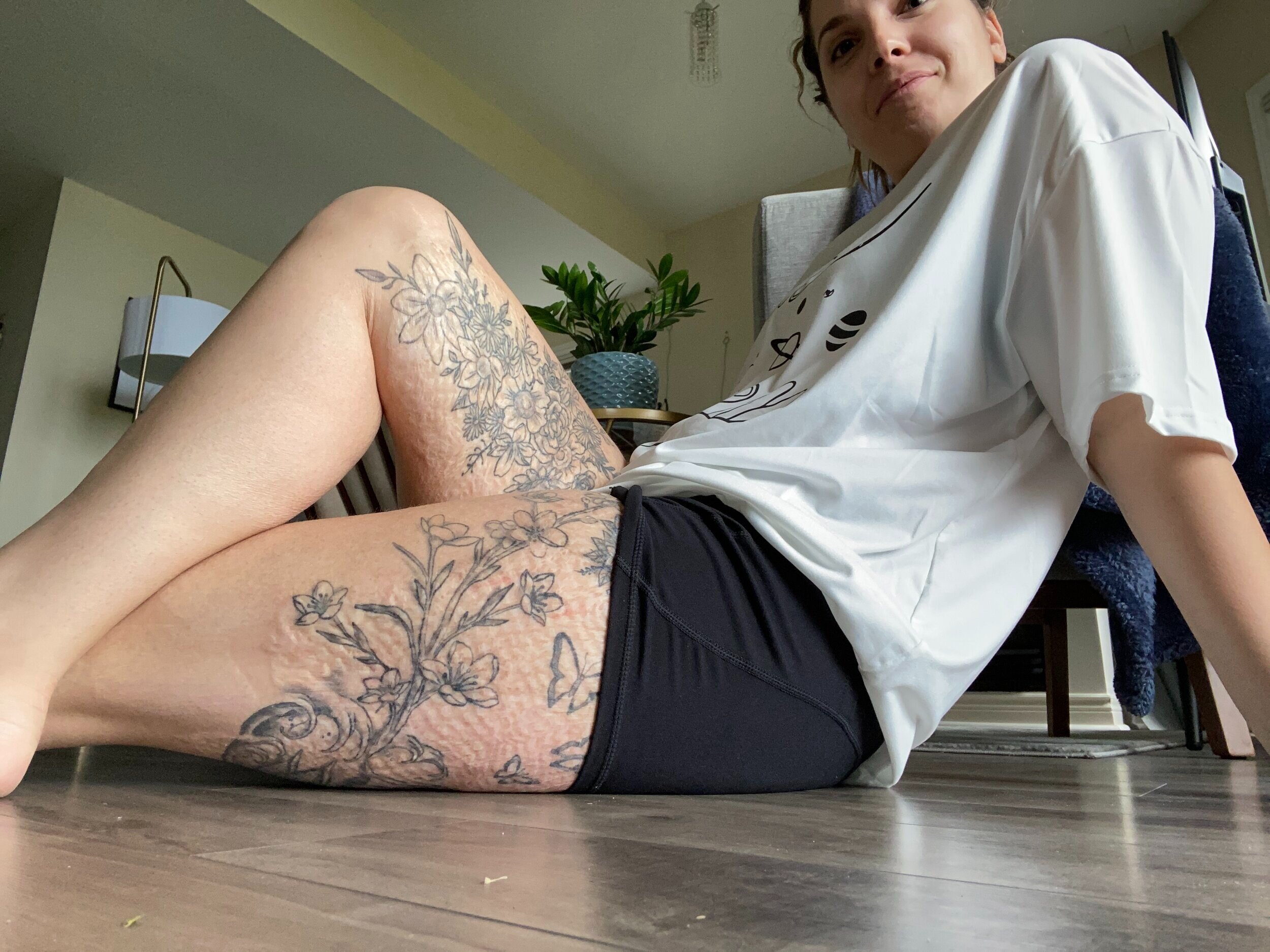  I started getting tattoos on my scars after a few years of deliberation. The tattoos have helped my confidence, and if you’re wondering, tattooing actually hurts less on the scars, at least for me!  