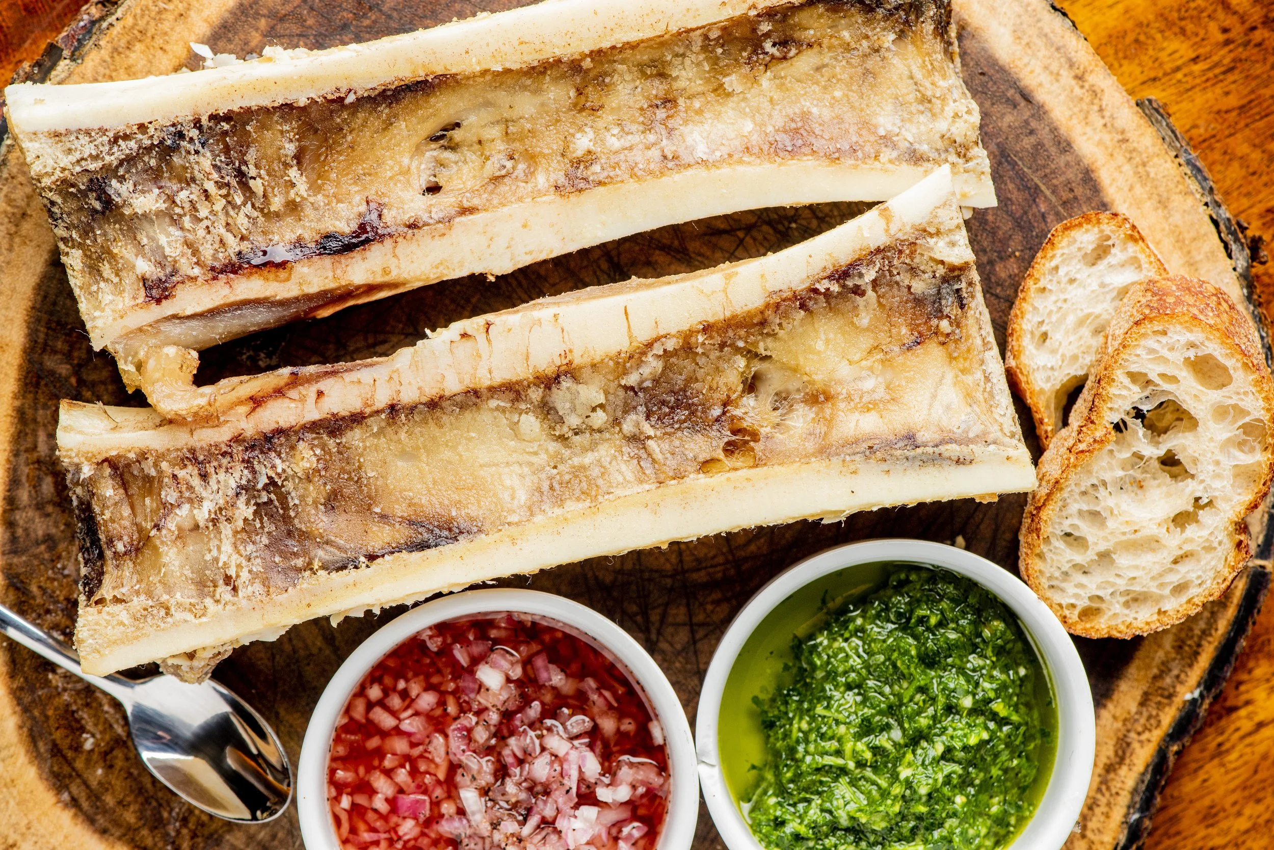 Bone Marrow_027.jpg