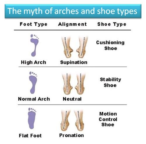 III. Types of Arch Types