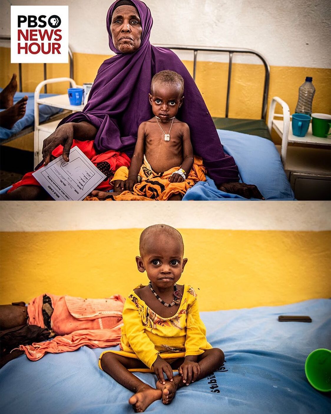 A humanitarian catastrophe is rapidly escalating in Somalia. 5 failed rainy seasons have led to a record drought. Now over half of Somalias 7 million population face chronic hunger. 
Tens of thousands are desperately fleeing their villages in search 