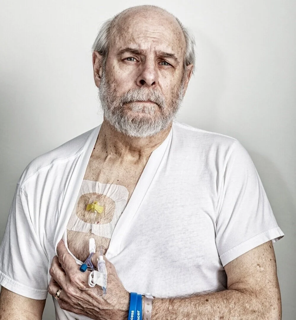 Patient+with+chemo+port+with+oral+mucositis%2Fcancer+mouth+sores