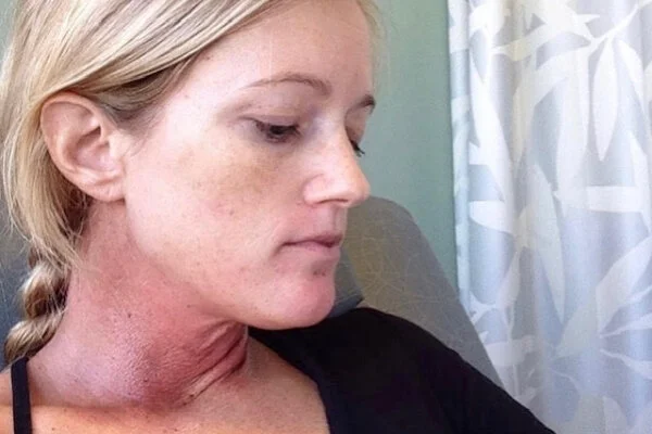  I wasn’t able to speak, and I couldn’t eat or drink ANYTHING