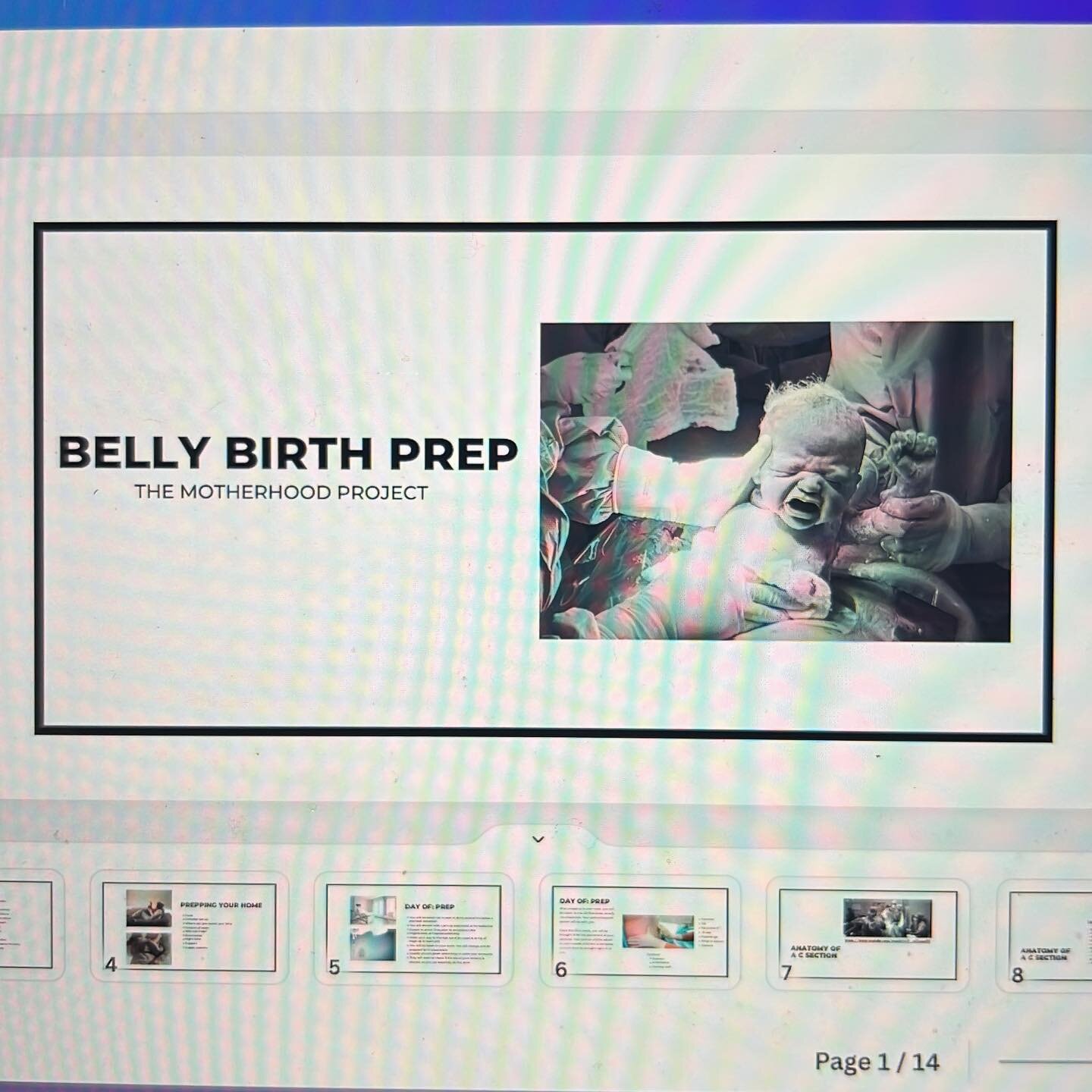 Having a C-Section?

We have a course for that! 

 Belly Birth Prep includes but is not limited to the following:

⭐️ What is a C-section and why might you need one?

⭐️ What to pack/what you do not need!

⭐️ Prepping your home

⭐️ Day of prep

⭐️Ana