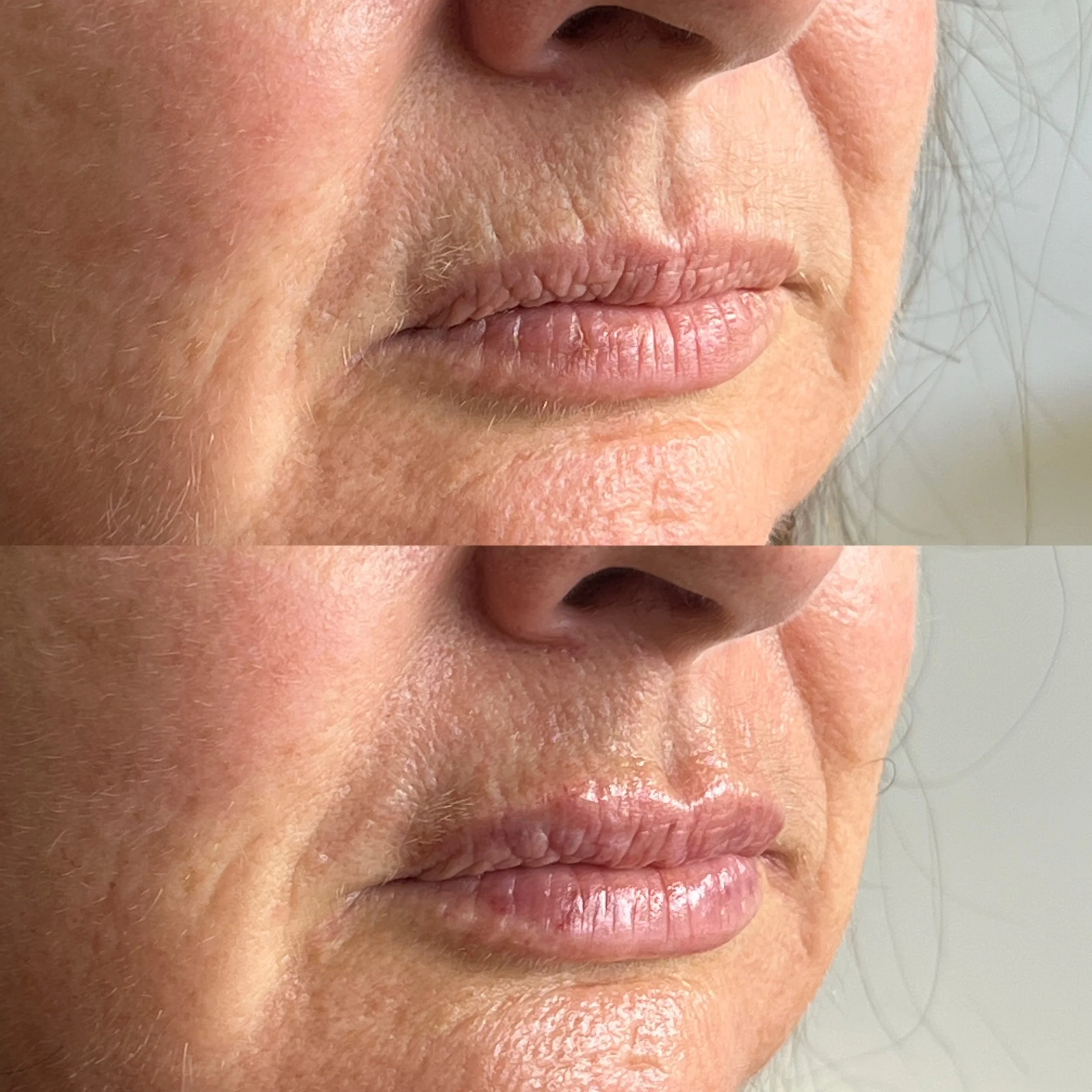Lips 1.JPG