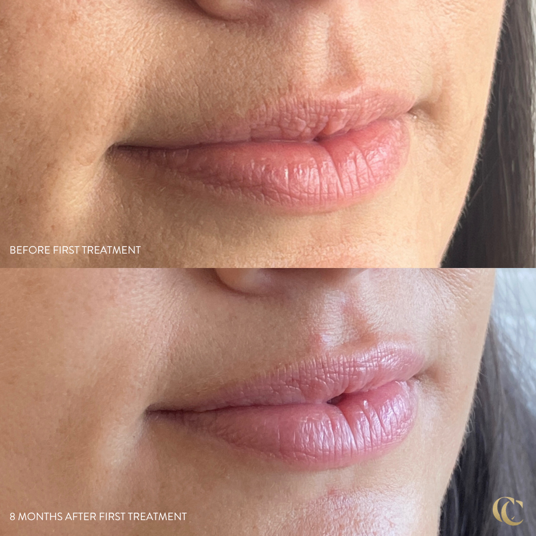 Lips 2.png