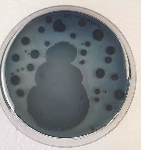  Snowman:  Streptomyces coelicolor  M145.&nbsp;This  Streptomyces  produces the antibiotic actinorhodin which diffuses into the agar and dyes it blue. At prolonged incubation, the cells will start to produce spores as a survival mechanism, which woul