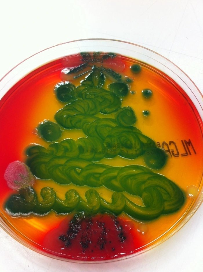  Bacteria tree on chromogenic agar plate. The green foliage is  E. coli , the pink baubles are  Pseudomonas aeruginosa , and the star and tree trunk are  Enterobacter cloacae . But with the  E. coli  being motile, it has invaded the star, trunk and b