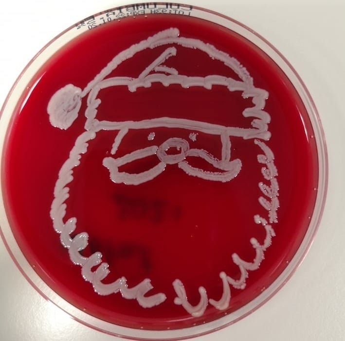   Staphylococcus aureus  on blood agar.  Photo by Joana Aguilar from Portugal. 