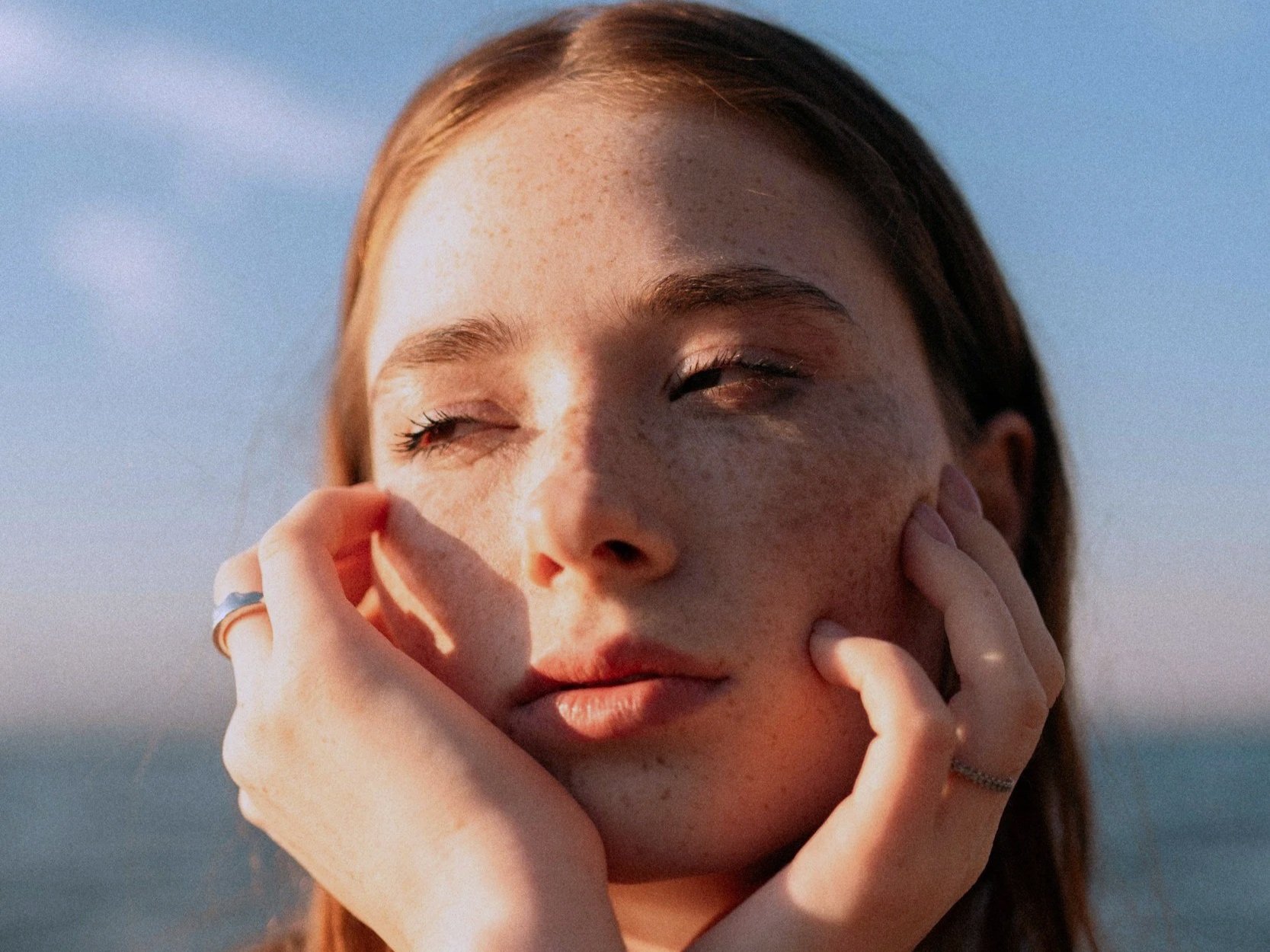 Microneedling: Why Summer Is the Perfect Time to Start Your Glow-Up