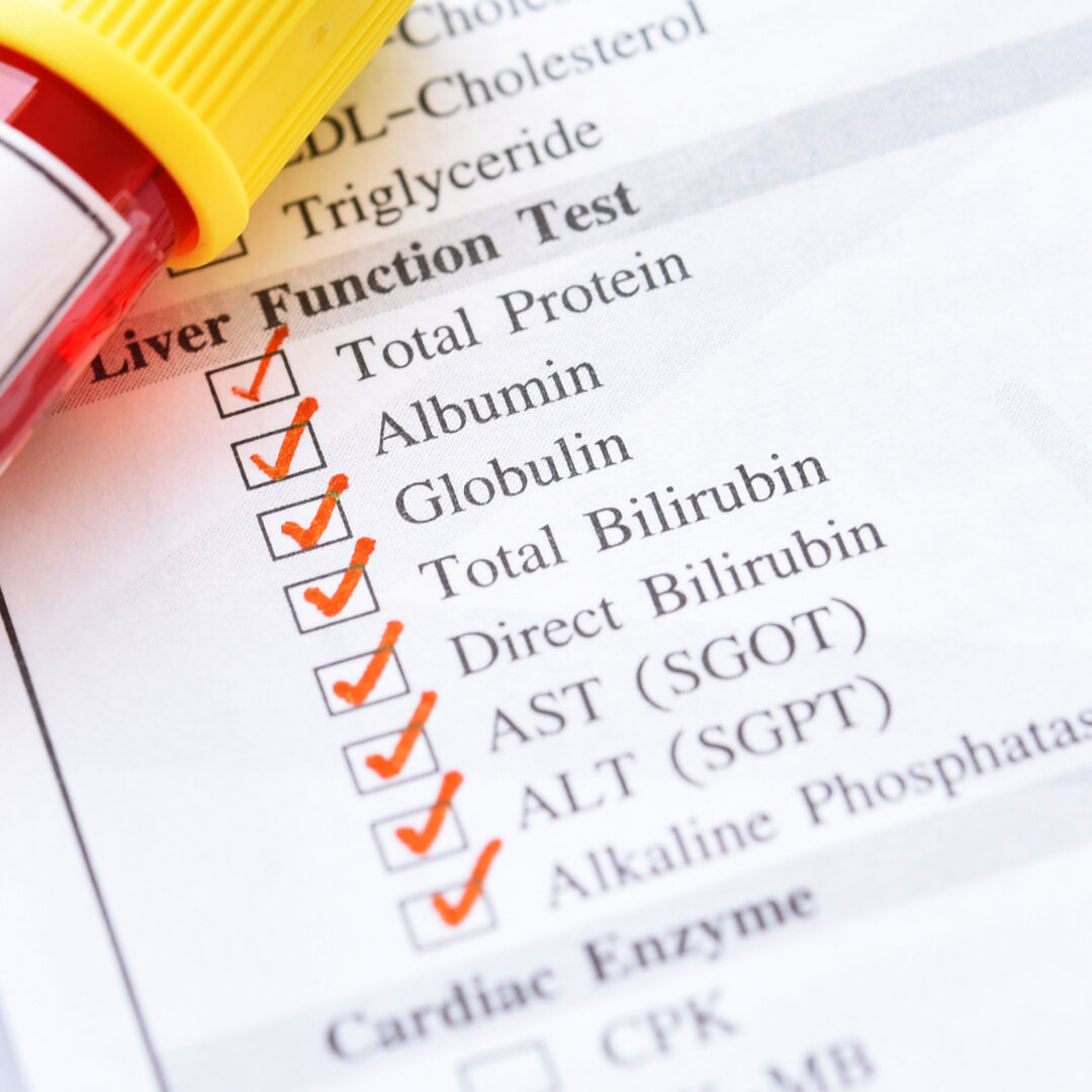 Want to know the difference?​​​​​​​​
​​​​​​​​
The functional health approach to blood analysis...​​​​​​​​
​​​​​​​​
Your blood test results are analysed with all body systems in mind, using optimal physiology as the benchmark.​​​​​​​​
​​​​​​​​
As a nu