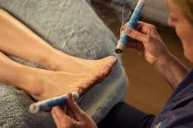Turning a Breech Baby Naturally: Can Moxibustion Help?