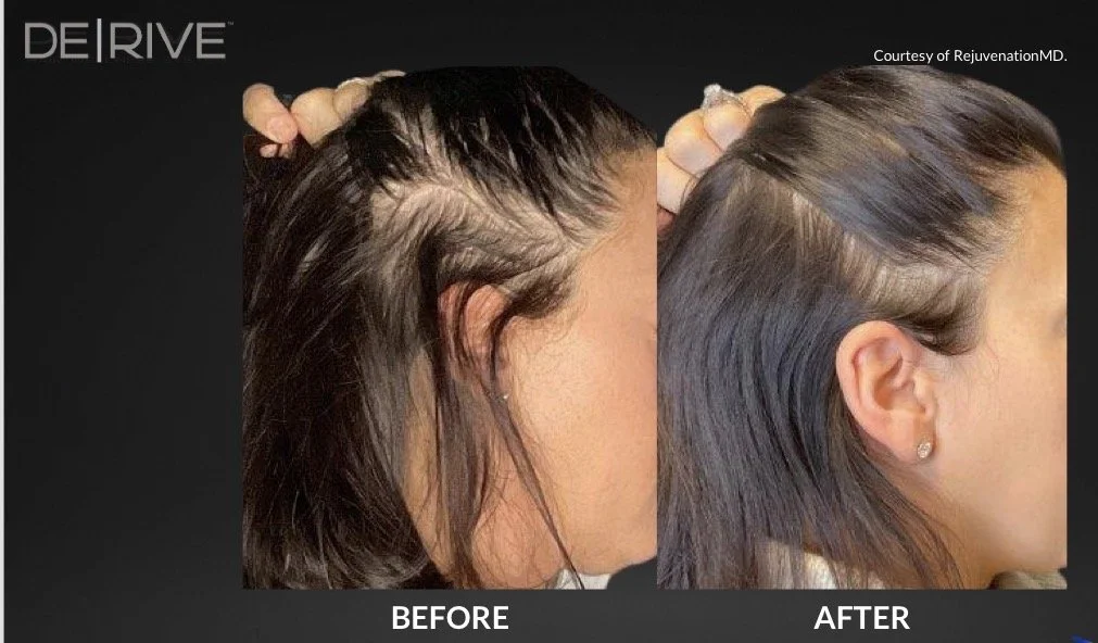 Comparison of hair before and after a hair transformation, showing longer, smoother hair after treatment.