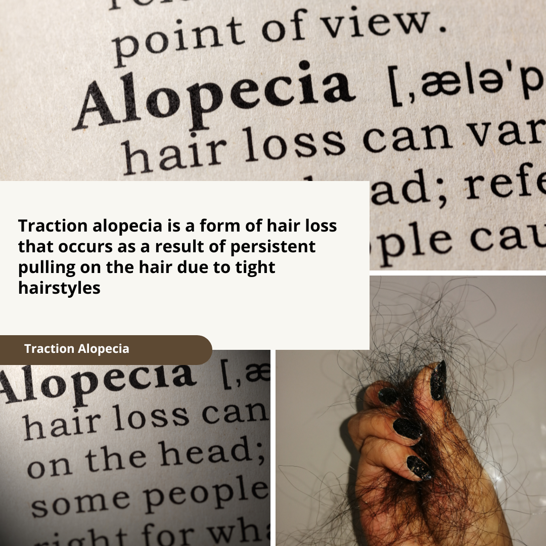 traction alopecia posts.png
