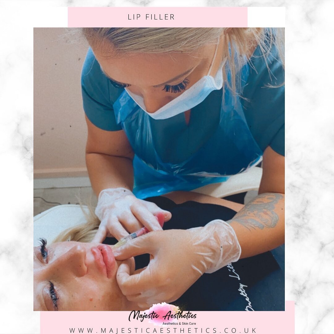 Do you have any burning questions about lip filler?

Many of my clients (and myself) would be more than happy to answer your questions, if you feel comfortable to drop any questions in the comments then please do so as previous clients can give you t