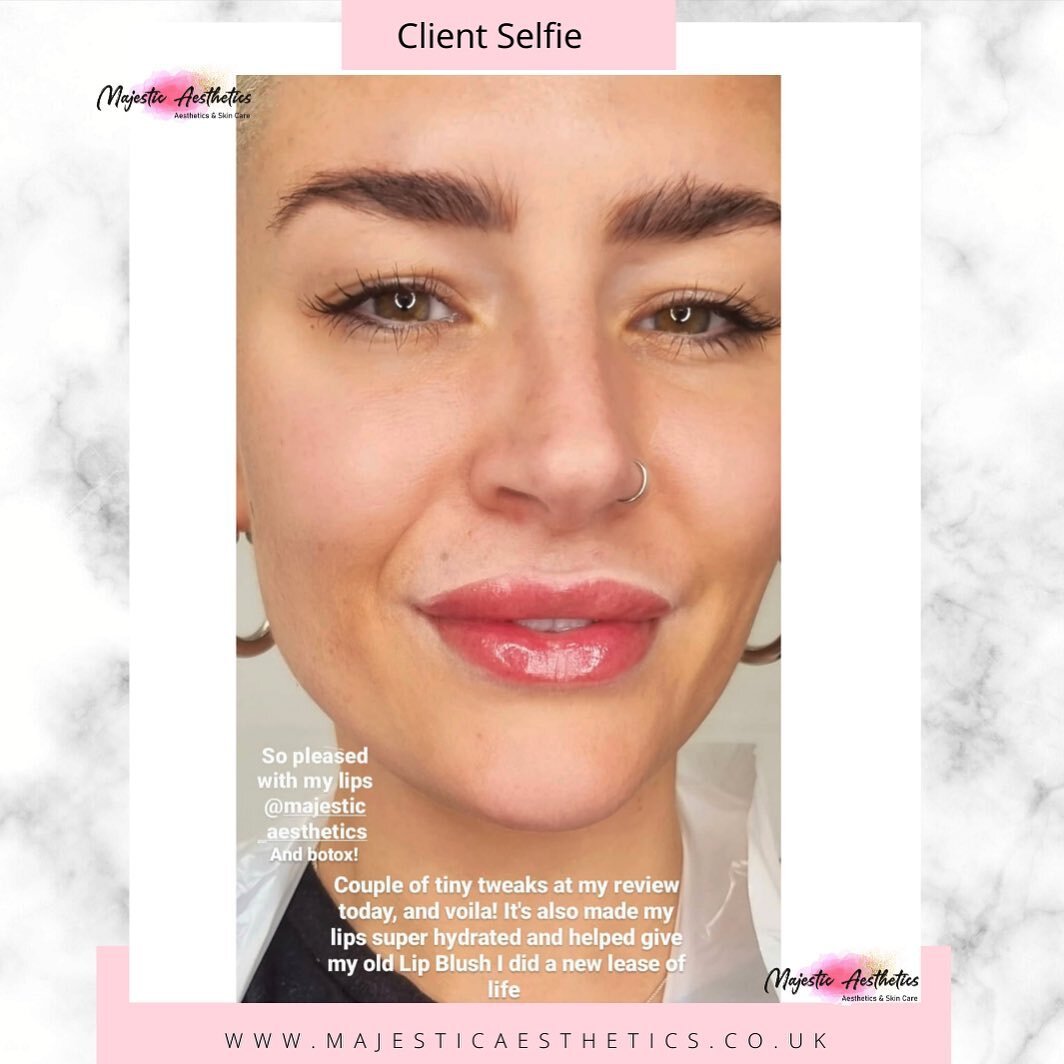 &lsquo;So pleased with my lips and Botox&rsquo; 😍

Who doesn&rsquo;t love a beautiful client selfie 🤳🏻.. I could just smother my insta grid with everyone&rsquo;s faces if I could haha.

Kerry has a beautiful enhancement yet still looking natural a