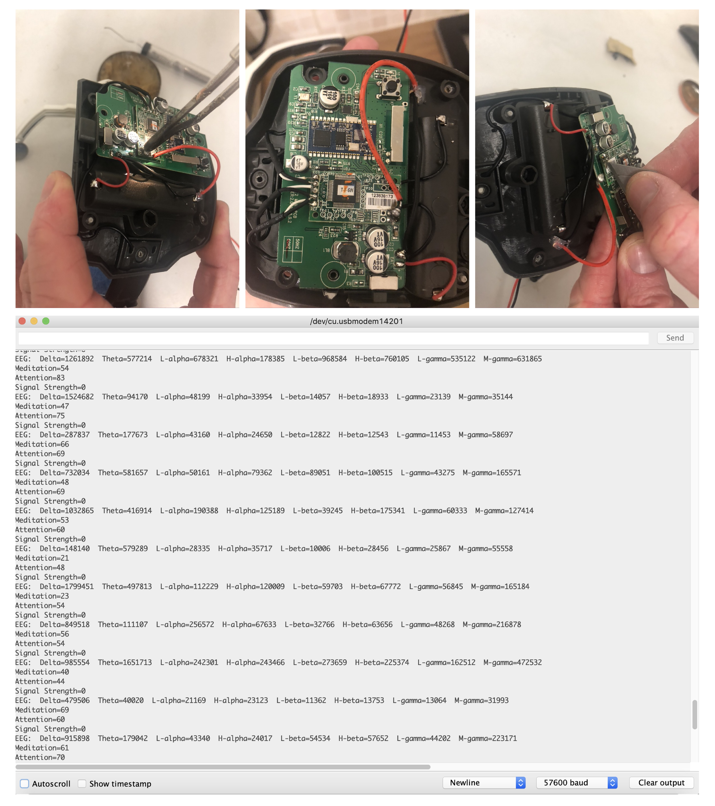 EEG Scanner-05.png