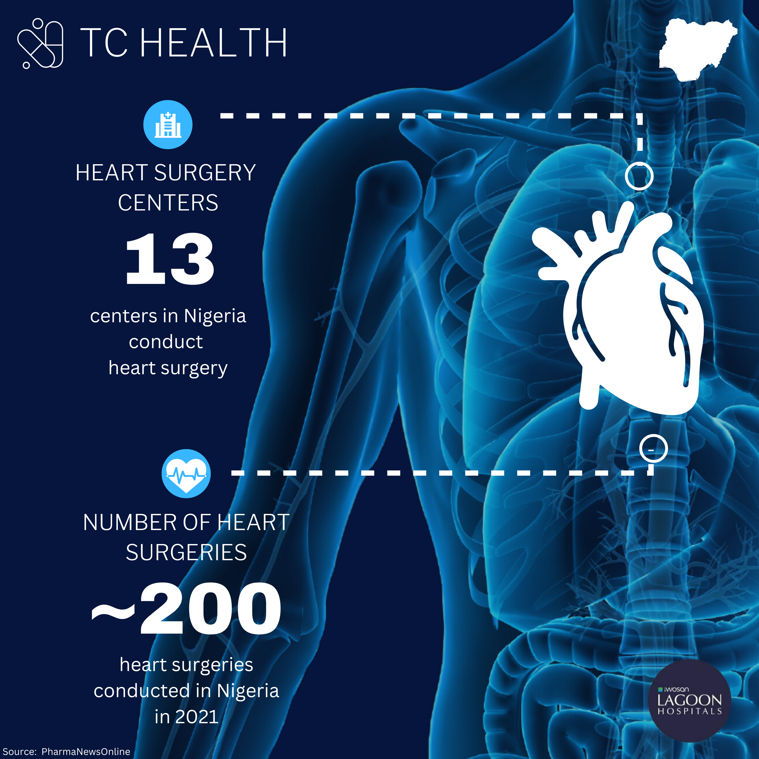 The Heart of Nigeria's Healthcare Crisis: How Cardiovascular Disease is ...