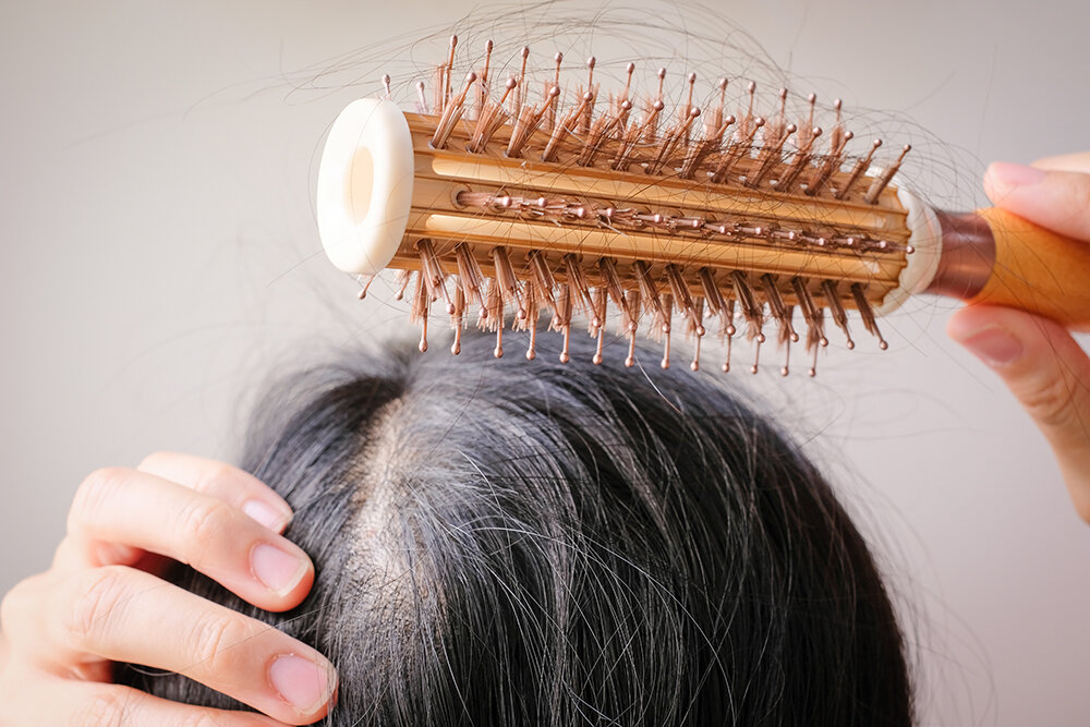 Can Women Get NeoGraft? Plus 7 Other Questions Ladies Have About Hair Loss  & Restoration — Dr. Aboutanos