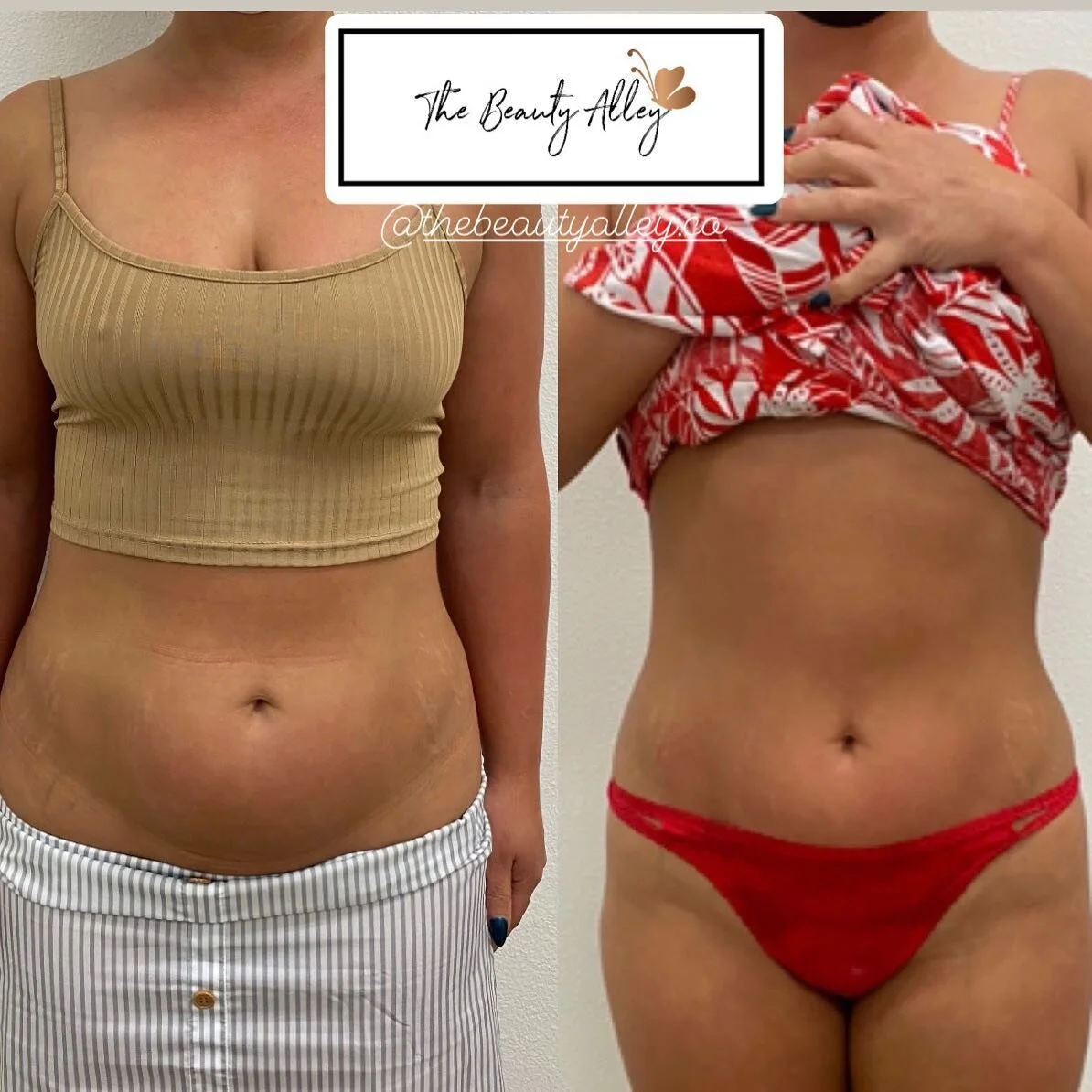 🛑 DON&rsquo;T MISS OUT ON OUR CURRENT SALE 🛑 $100 OFF Any Service ! Only valid up until June 10th. You must Book your appointment by June 10th.