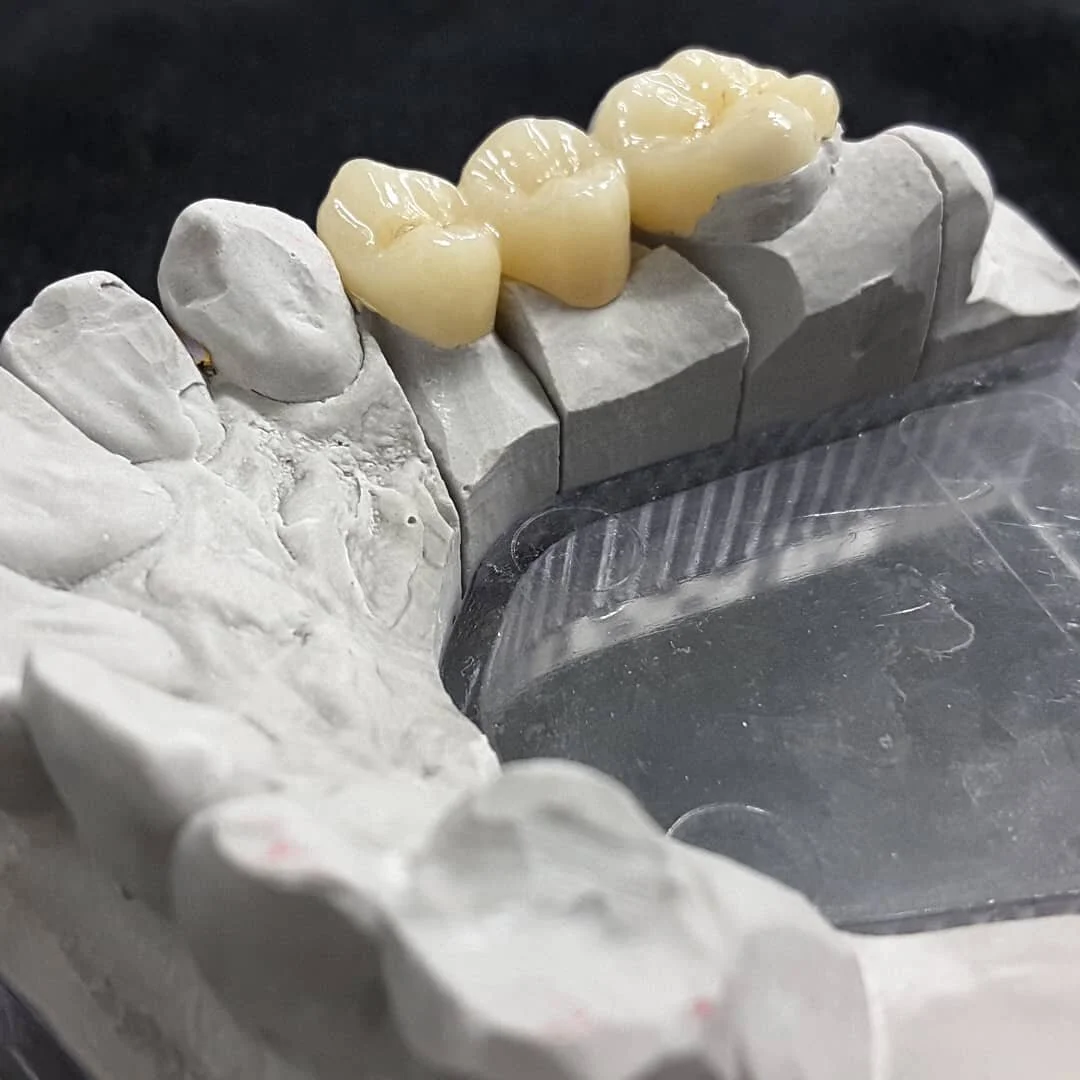 Full form multi-layer zirconia bridge