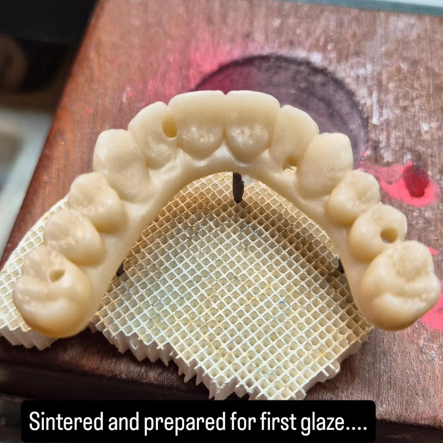 Our first ever all-on-four was a success. Great care and attention was taken every step of the way. Job was fitted this morning happy dentist very happy patient.....#allonfour #monolithiczirconium #dentaltechnician #miyo #dentallaboratory #straumanim