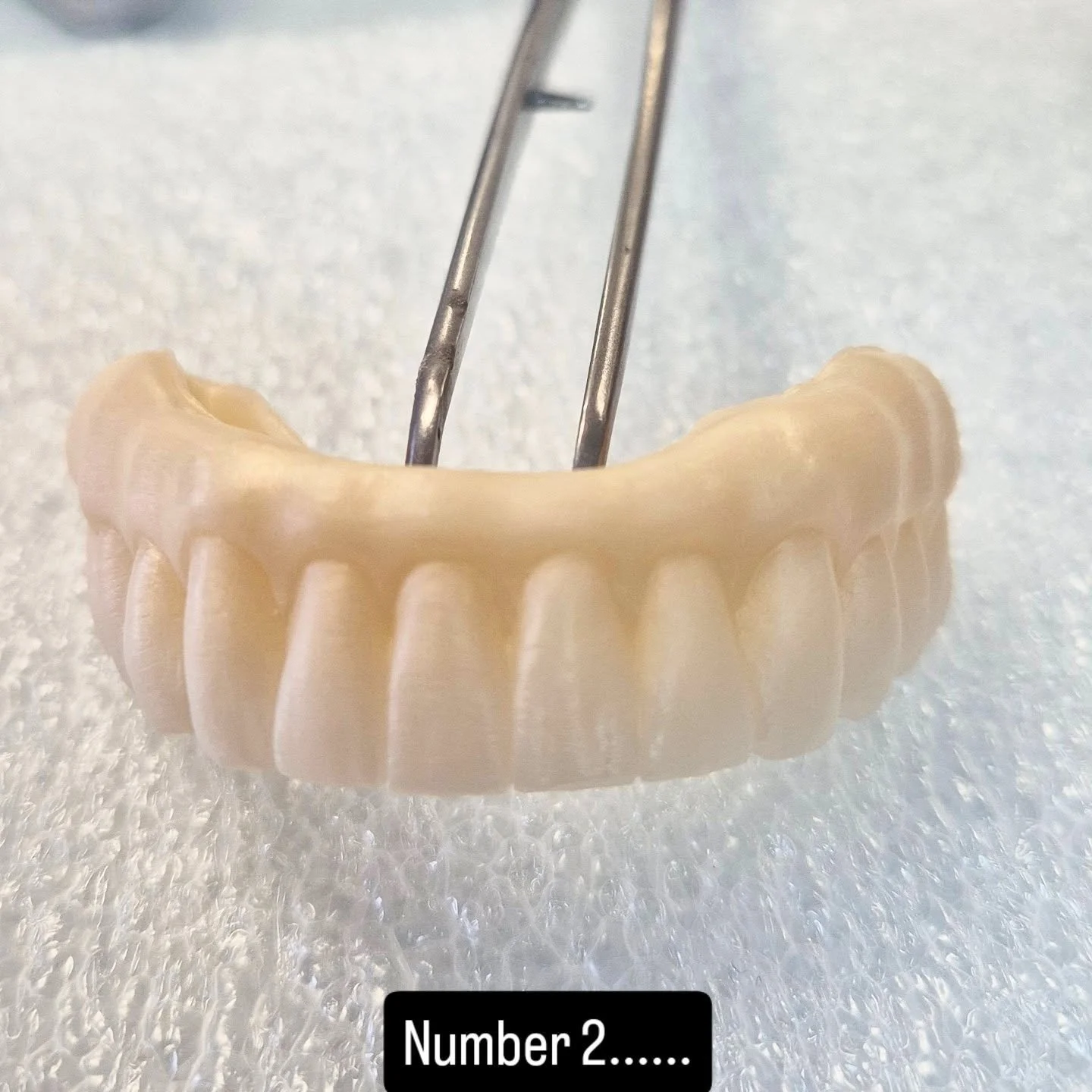 After a successful first all-on-four we just finished our second one.....so pleased with the results....using miyo...#monolithiczirconium #allonfour #straumanimplants #miyo #dentaltechnician #dentallaboratory #bayviewdentalceramics
