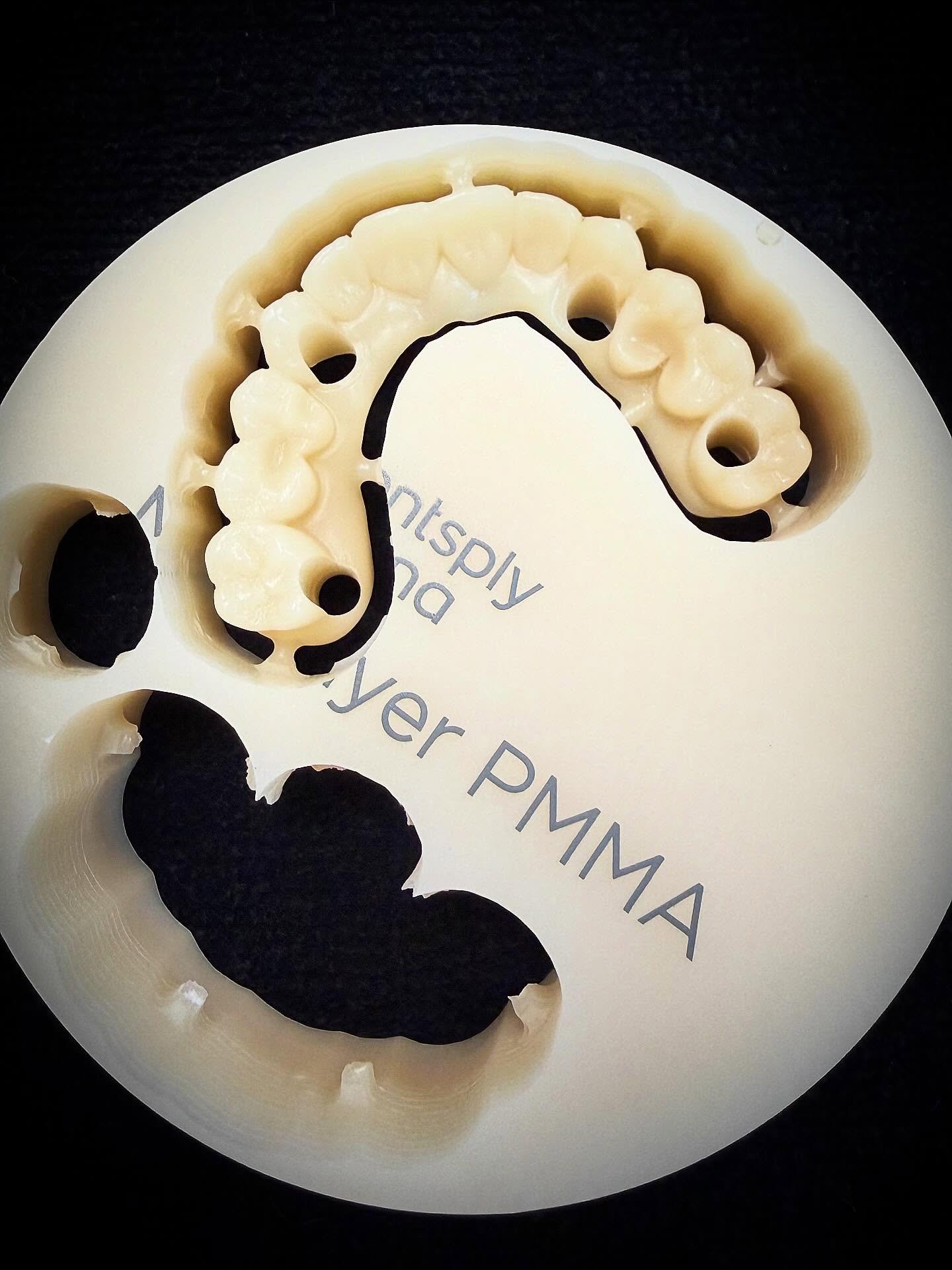 Full arch milled PMMA all on 4 temporary #dentsplysirona #pmma #dentalimplants #digitaldentistry #bayviewdentalceramics