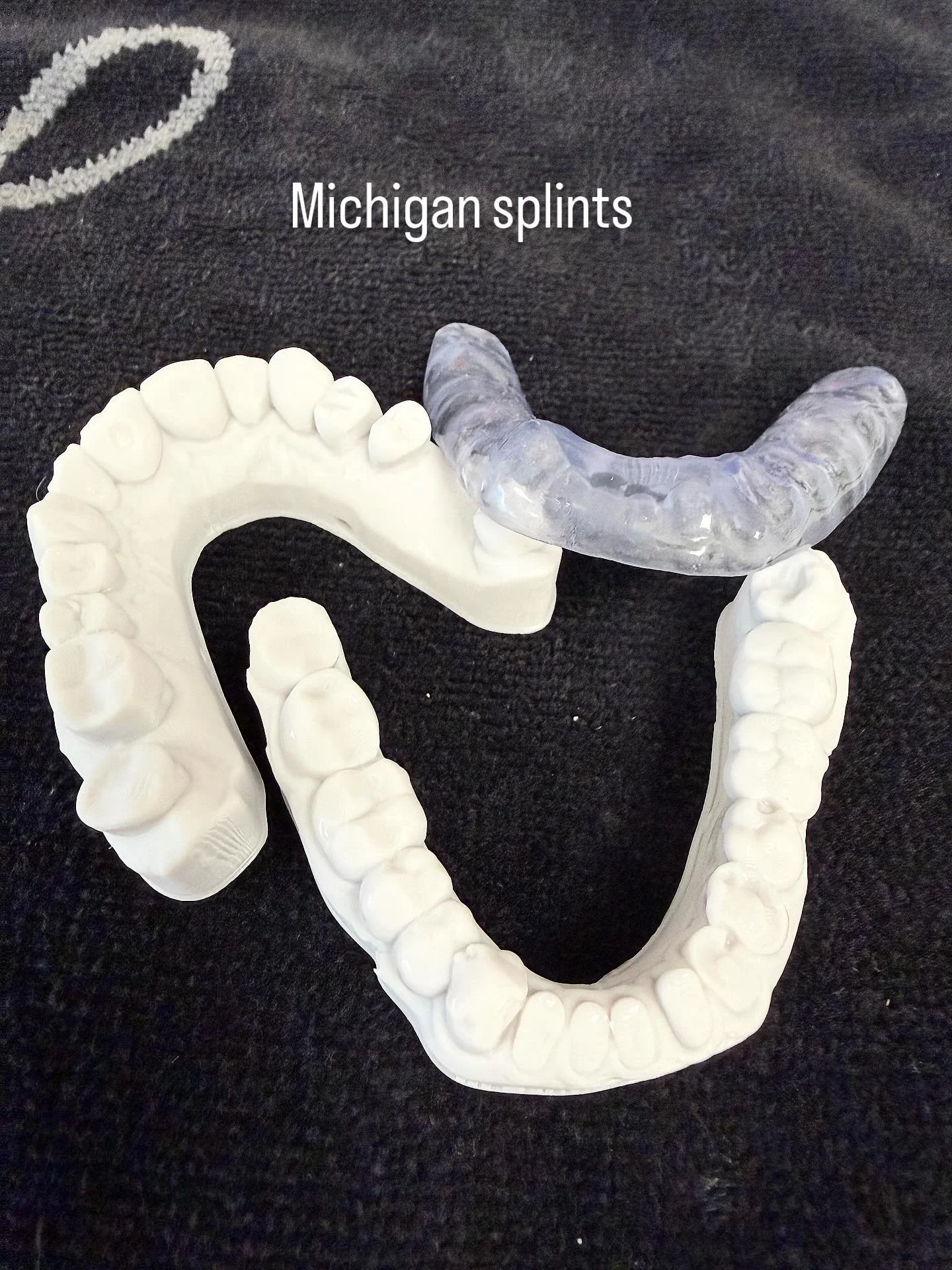 Precision printing splints and stents using Keyprint resins specific for each print. #keyprintresins #digitaldentistry #3dprinting #dentallaboratory #bayviewdentalceramics