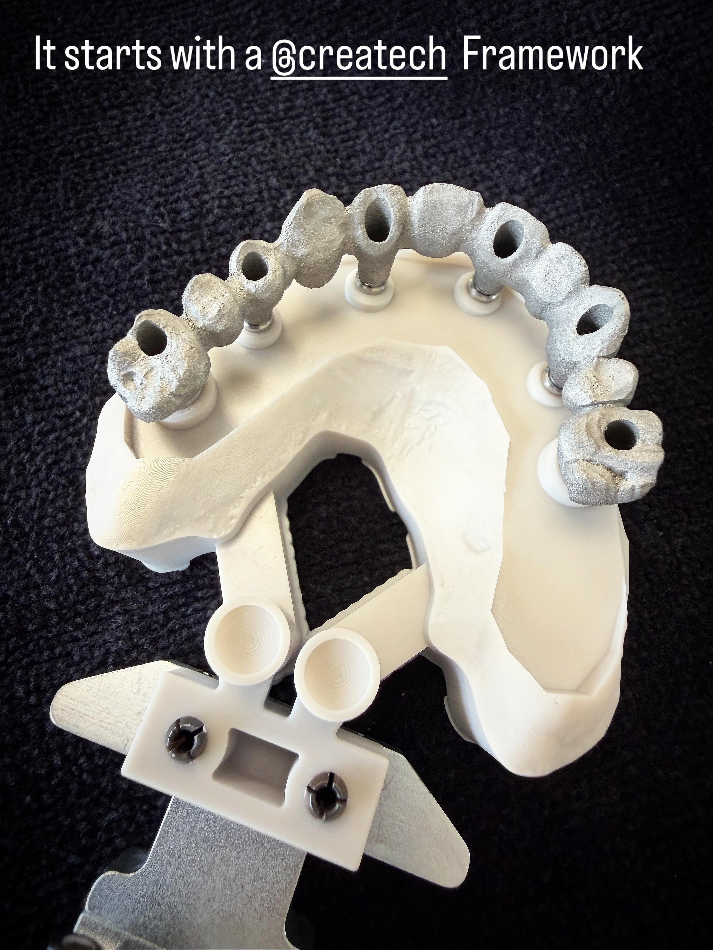 Doing things the right way starts at the very beginning! Starting with the design of the framework which we do in-house. The design gets sent to @createchmedical to create the framework in chrome cobalt. We then trim up the metal substructure. 2 laye