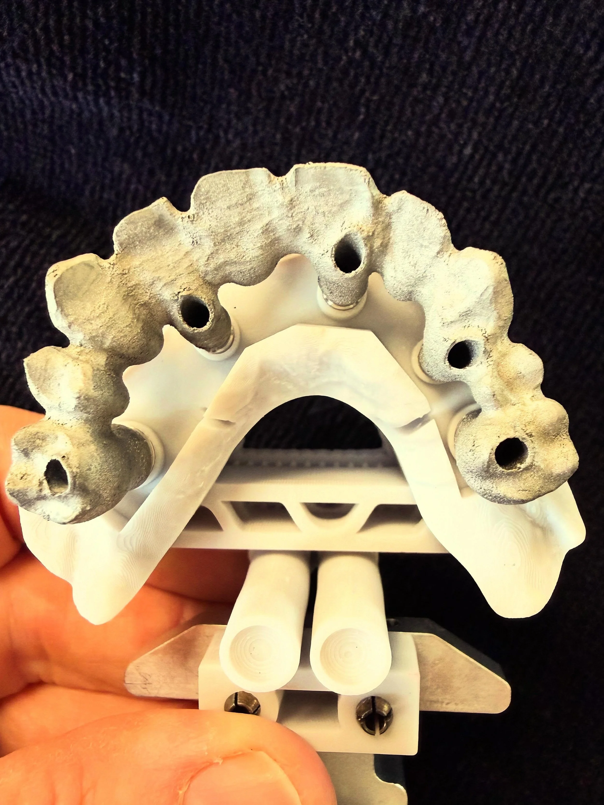At Bayview Dental Ceramics our temporary implant bridges are just as important as the finished result. We still use @createchmedical  for the metal framework. The frameworks are then prepared and the composite is added. Getting the bite correct is cr